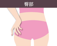 レーザートーニングの適応部位4:臀部